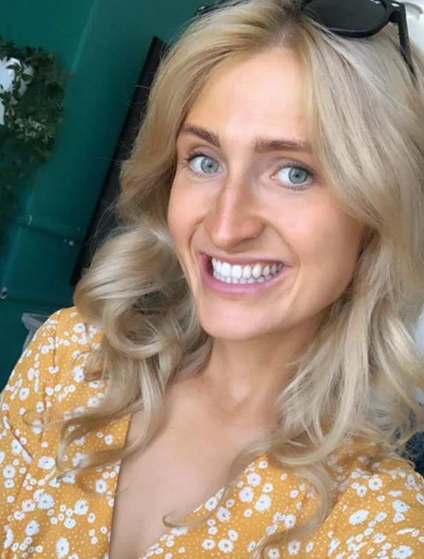 ava received invisalign treatment from beam orthodontics in dundee